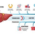 Fatty Liver Disease (NAFLD/MASLD): Fibrosis Risk and Clinic Monitoring